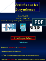 Generalites Osteosyntheses