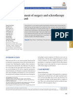 Combined Treatment of Surgery and Sclerotherapy For Sinus Pericranii