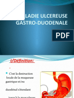 Ugd Et Complications