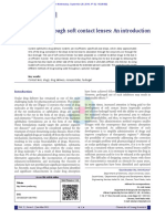 Drug Delivery Through Soft Contact Lenses An Intro