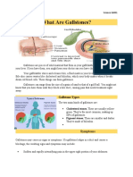 What Are Gallstones?: Lemuel Jay A. Segovia Grade 8-Peace Science Q4M1