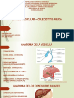 Colelitiasis Colecistitis