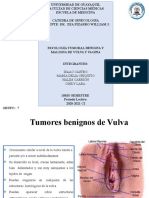 Patologia Tumoral Vulva 2 Final