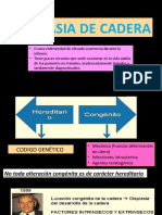 Displasia de Cadera