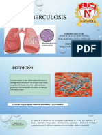 TUBERCULOSIS - Exp