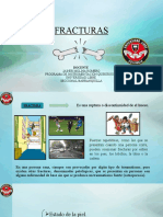 Fractura