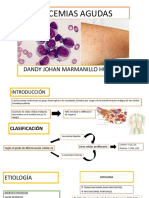 Leucemia Aguda