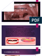 Candidiasis Oral