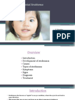 Congenital Strabismus: S. Vanitha, B.optom, 3 Year