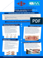 La Osteoporosis. Sus Efectos Sobre La Cavidad Bucal