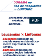 Neoplasias de Células Linfóides (Salvo Automaticamente)