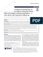 Esthetic and Functional Reconstruction of Large Mandibular Defects Using Free Fibula Flap and Implant-Retained Prosthetics - A Case Series With Long-Term Follow-Up