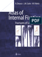 Atlas of Internal Fixation - Fractures of Long Bones. Classification, Statistical Analysis, Technique, Radiology (PDFDrive)