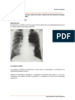 Drenaje Pleural-Neumotorax