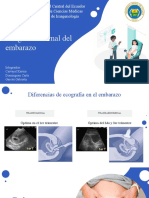 Tema 6 - Ecografía Normal Del Embarazo