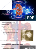 Neoplasias Renales