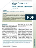 Frequently Missed Fractures in Pediatric Trauma