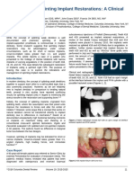 Indications For Splinting Implant Restorations