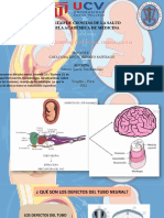 Defectos Del Tubo Neural, Trisomías 21 y 13