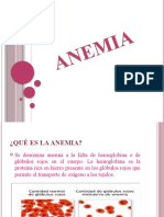 ANEMIA