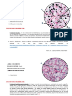 Esteatosis Hepatica