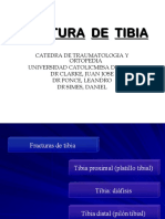 01 - Fractura Mediodiafisaria de Tibia