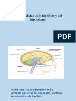 Enfermedades de La Hipofisis e Hipotalamo
