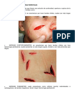Tipos de Lesión y Sus Características