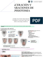 Laceración y Reparaciones de Episiotomia