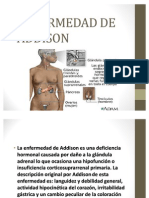 Enfermedad de Addison