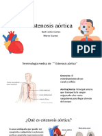 Estenosis Aórtica