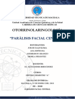 Paralisis Facial Central