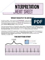 ECG Interpretation Cheat Sheet