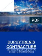 Dupuytren's Contracture