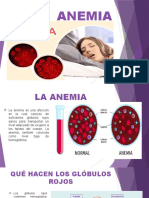 ANEMIA