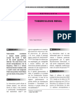 Tuberculosis Renal