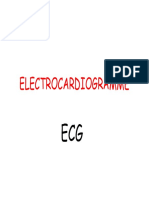 Elécrtocardiogramme ECG