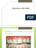 Altc3a9rations Rc3a9gressives Des Dents1