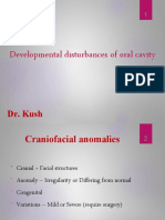 Developmental Disturbances of Oral Cavity-Kush