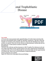 Gestational Trophoblastic Disease