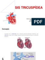 Estenosis Tricuspídea: Edwin Salvador Cuyo Gonzales Médico Internista Asistente de HRDLM