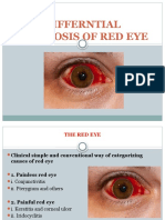 D.D of Red Eye