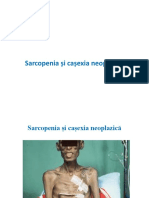 Sarcopenia Si Cașexia Neoplazică