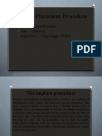 Implant Epp