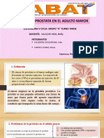 15 - Cancer de Prostata