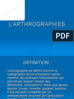 Arthrographie Genou M BENARIFA