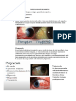 Neoformaciones de La Conjuntiva