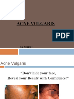 Acne Vulgaris