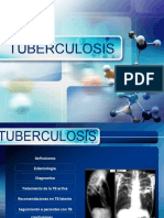 Tuberculosis