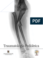 Traumatologia Pediatrica 2023